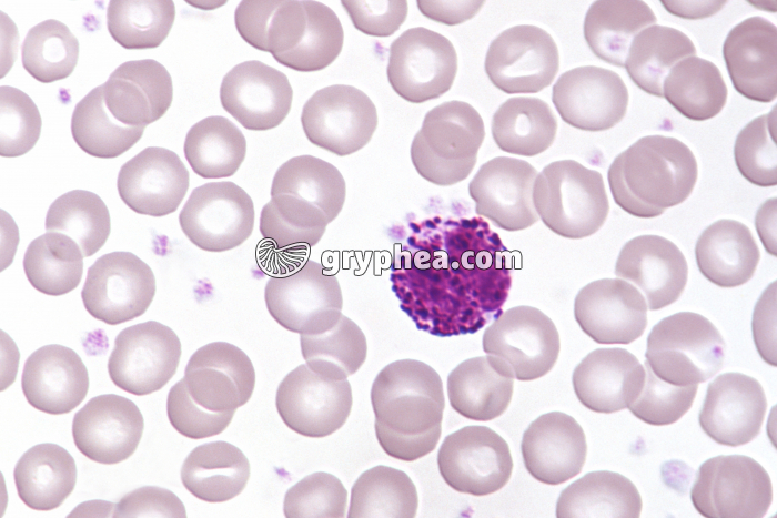 Granulocyte Basophile x400 - gryphea.com